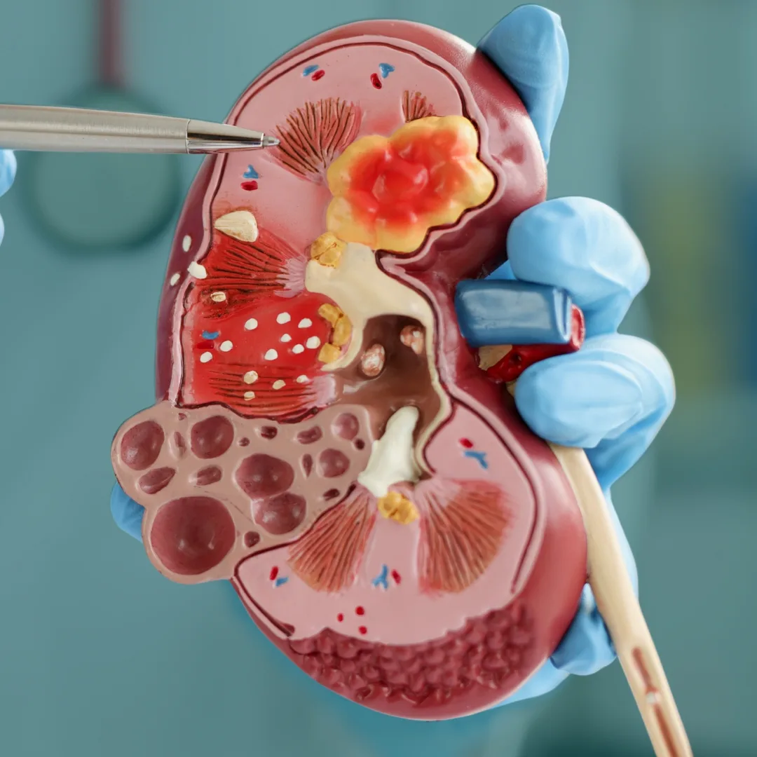 Urologia na Liorci Clinic